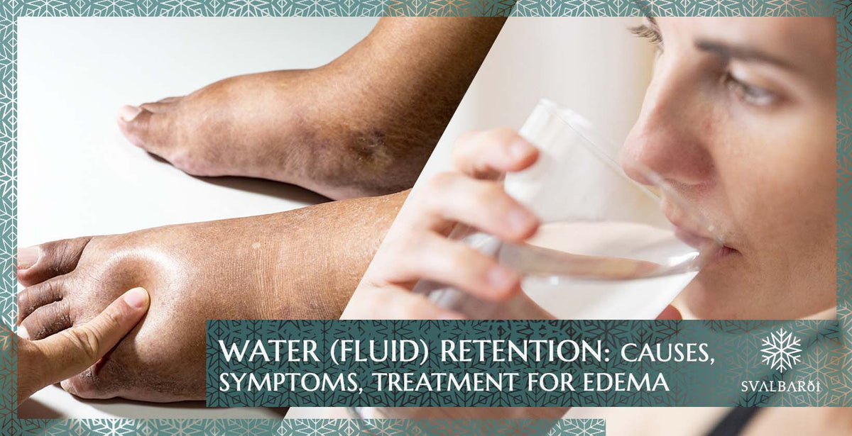 Water (Fluid) Retention: Causes, Symptoms, Treatment for Edema – Svalbarði  Polar Iceberg Water
